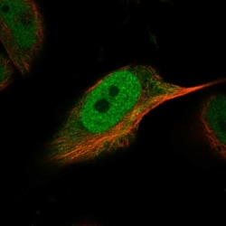 ATE1 Antibody, Novus Biologicals:Antibodies:Primary Antibodies